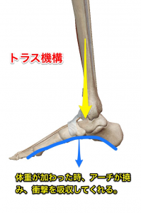 トラス機構