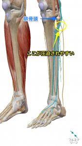 腓骨頭