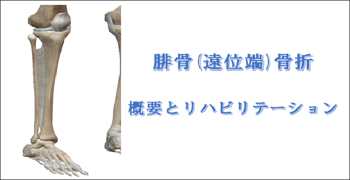 足首の骨折『腓骨骨折』の原因・症状・リハビリ治療について解説