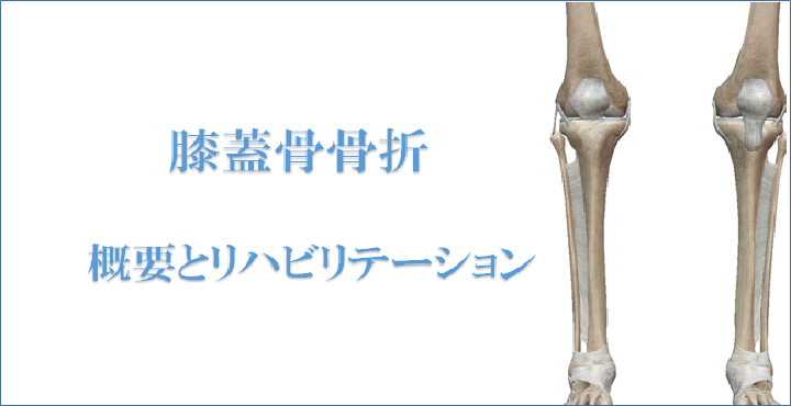 膝のお皿の骨折 膝蓋骨骨折 の原因 症状 リハビリ治療について解説をします リハビリテーションコンサルタント